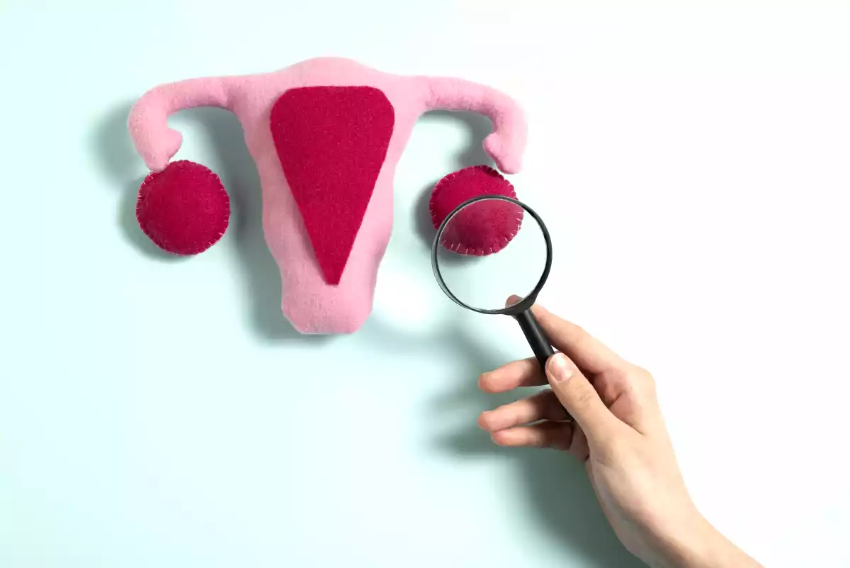 Endometriose e dieta: as chaves para um melhor controle dos sintomas!